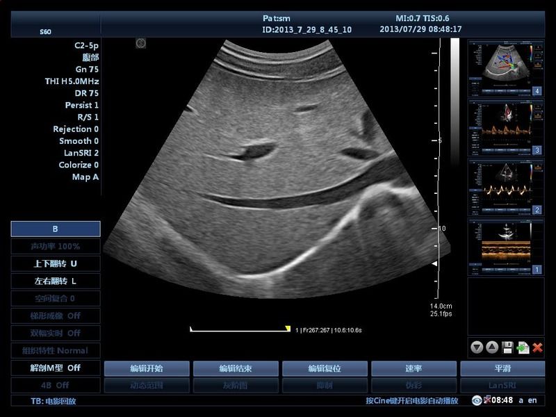 Больничная ванная тележка 15 дюймовая УЗИ УЗИ Цифровая цветовая УЗИ Допплера УЗИ Эдикальные